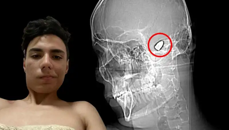 Kafasında Patlayıcı Var: Psikolojik Gerilim Hikayesinin Derinlikleri